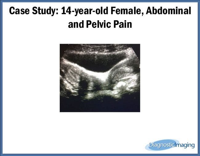 14-year-old Female, Abdominal and Pelvic Pain