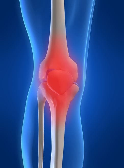 MRI for Traumatic Knee Injury Does Not Add to Improvement in Outcome