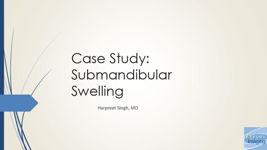 Submandibular Swelling