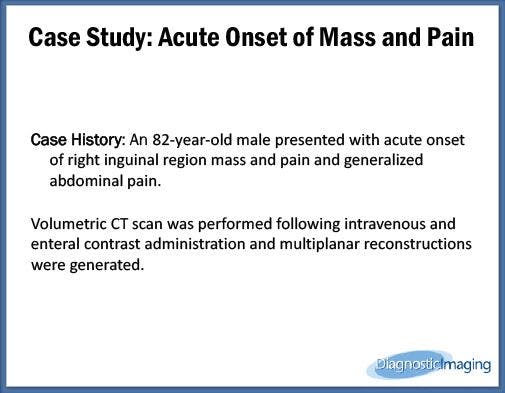 Acute Onset of Mass and Pain