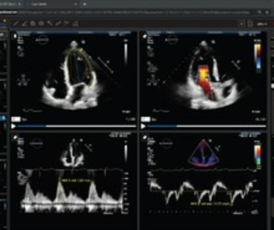 Pie Medical Imaging Launches AI-Powered Echocardiography Platform