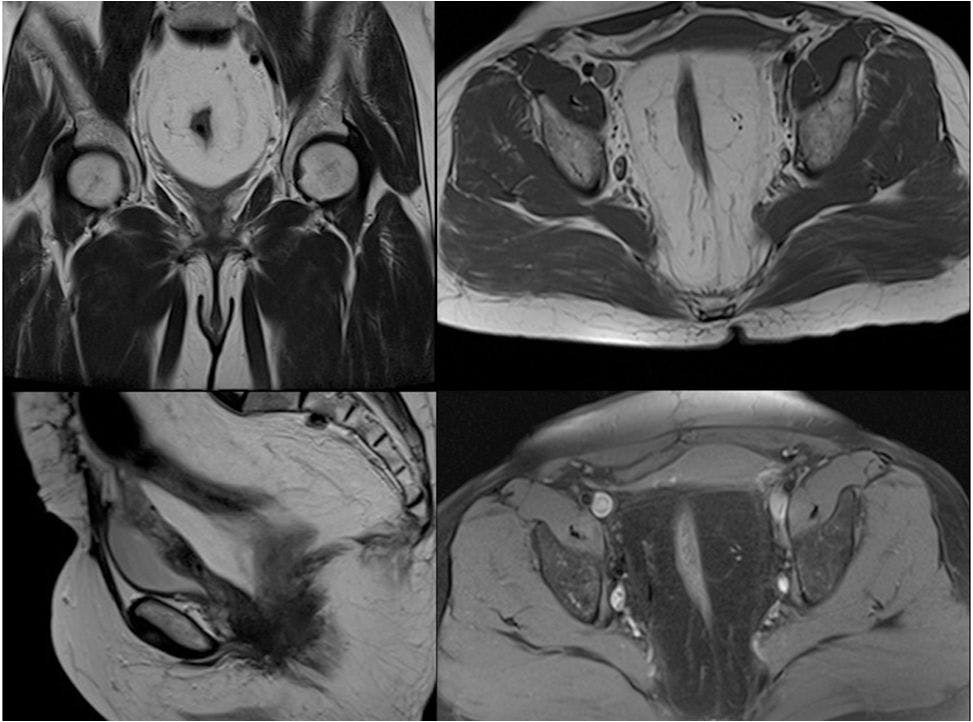 Image IQ: 45-year-old Woman, Nonspecific Pelvic Pain and Fullness