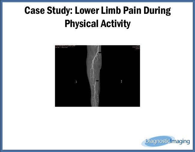 Lower Limb Pain During Physical Activity