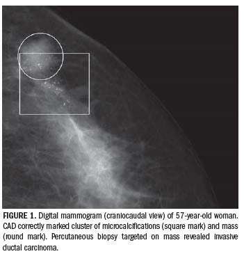 CAD comes under scrutiny  in breast screening debate