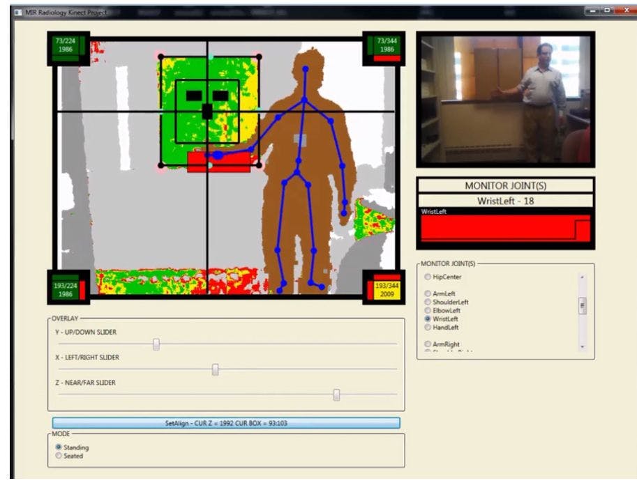 Gaming Console Software Improves Radiography Images