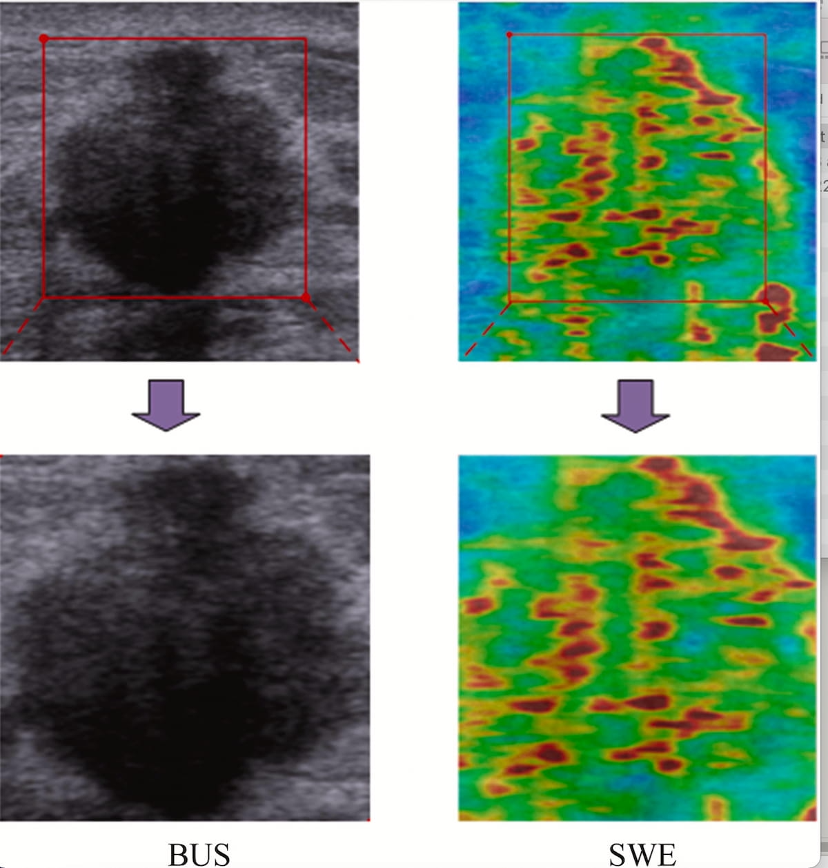 Can an AI Combination of Ultrasound and Molecular Data Predict Adjunctive Chemotherapy Response in Breast Cancer Patients?  