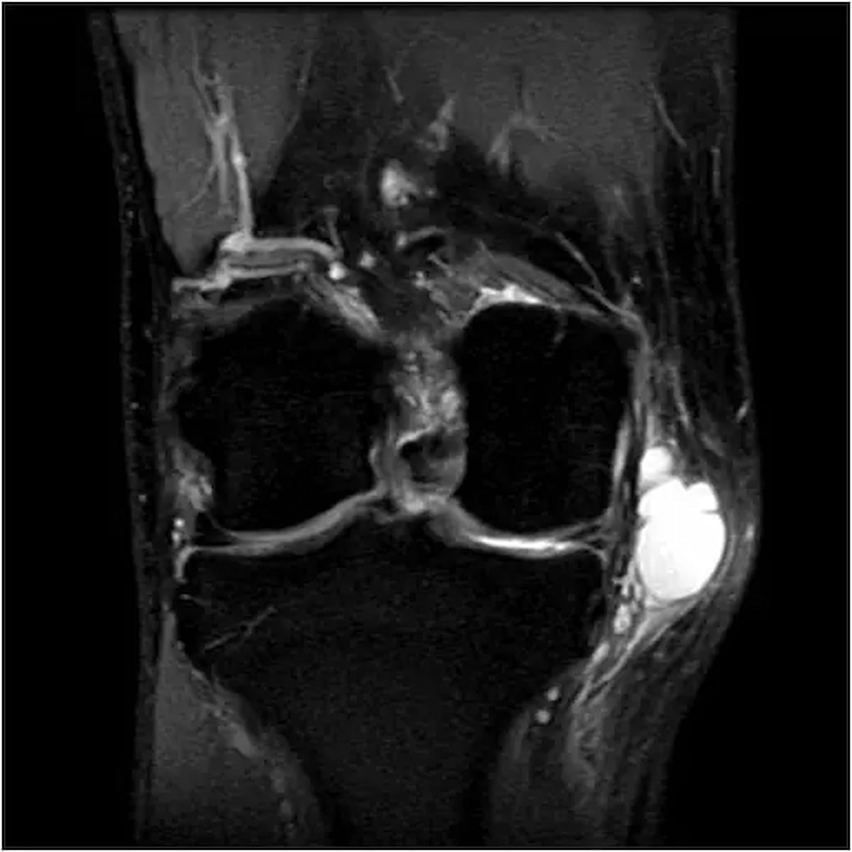 Image IQ Quiz: 30-Yeear-Old Patient with Knee Pain
