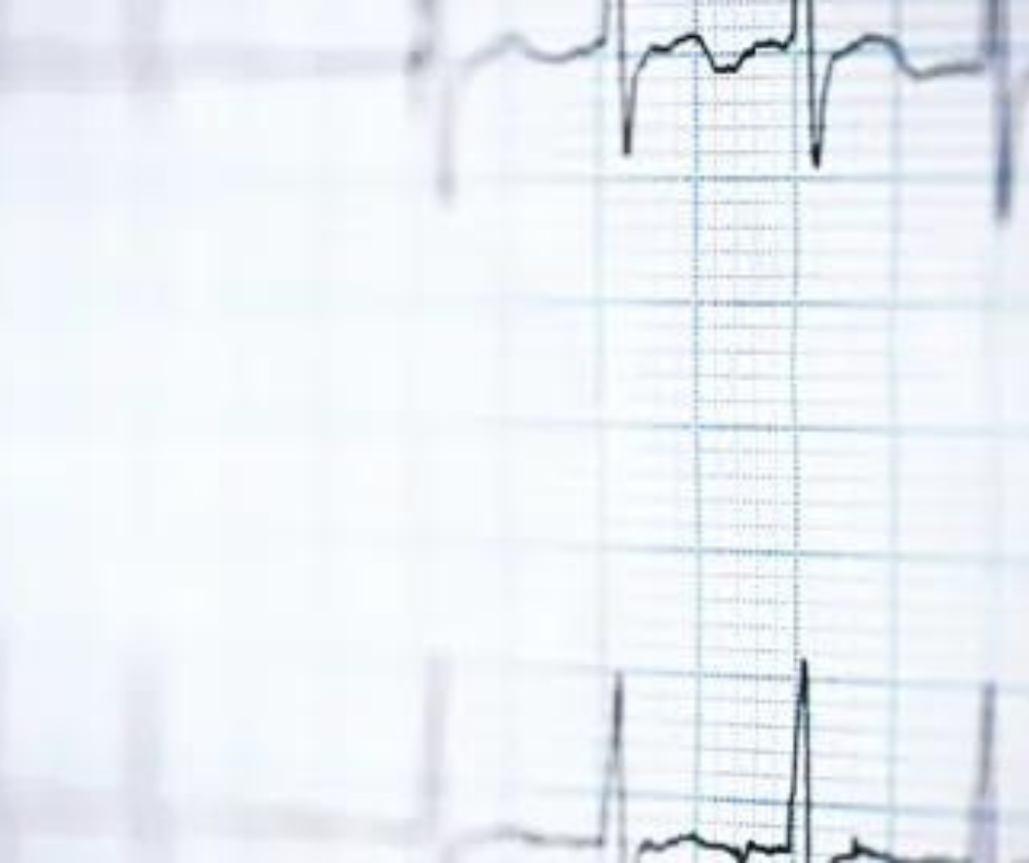 Study Says Combination of AI and Electrocardiogram May Enhance Detection of Diabetes Risk