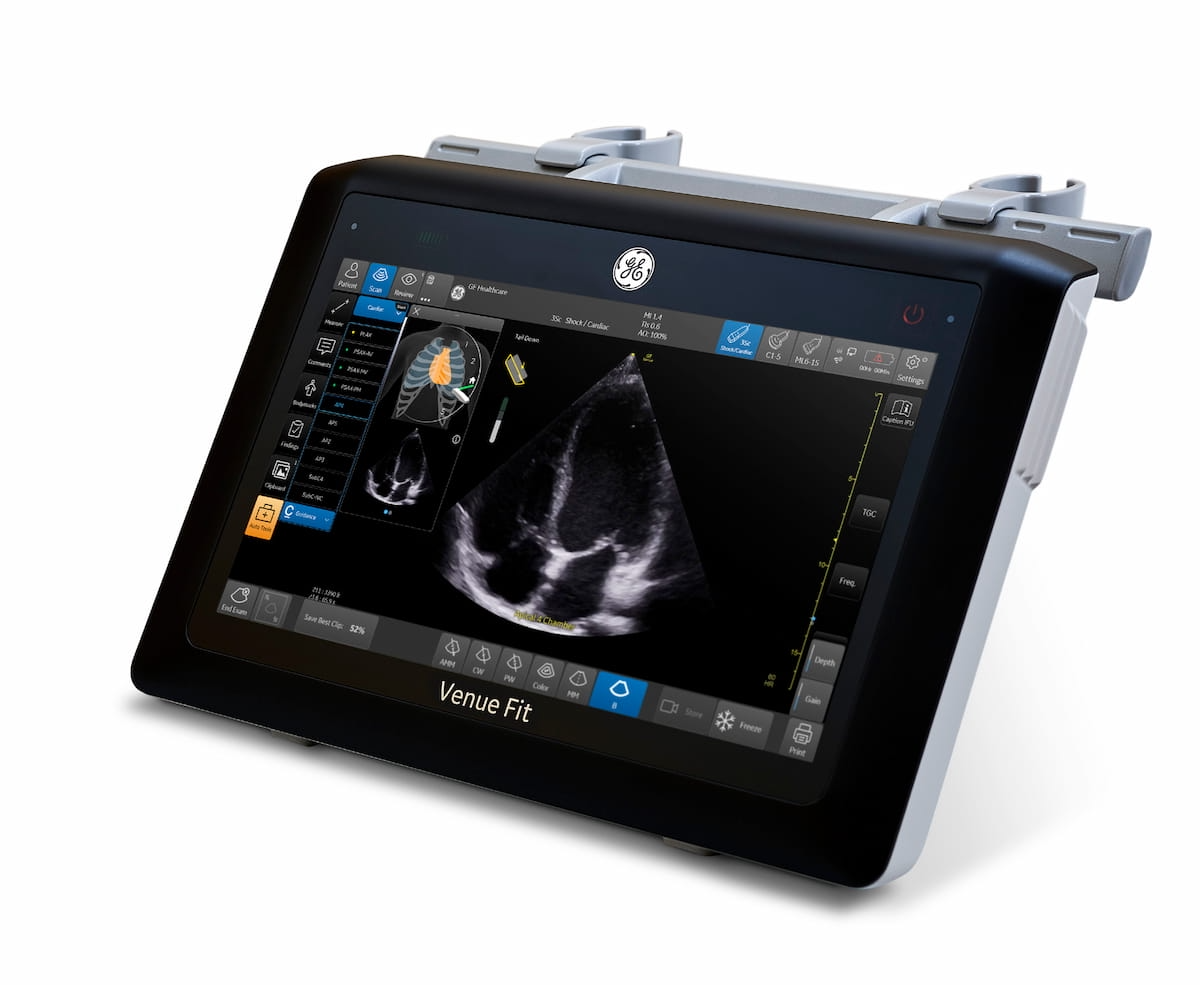 GE HealthCare Adds Real-Time AI Guidance to Venue Family Ultrasound Systems