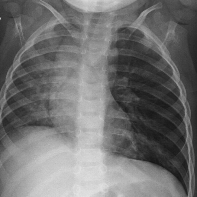 Image IQ Quiz: Patient Presents with Shortness of Breath and Distress