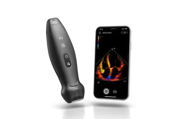 Mindray Launches New Handheld Ultrasound Device