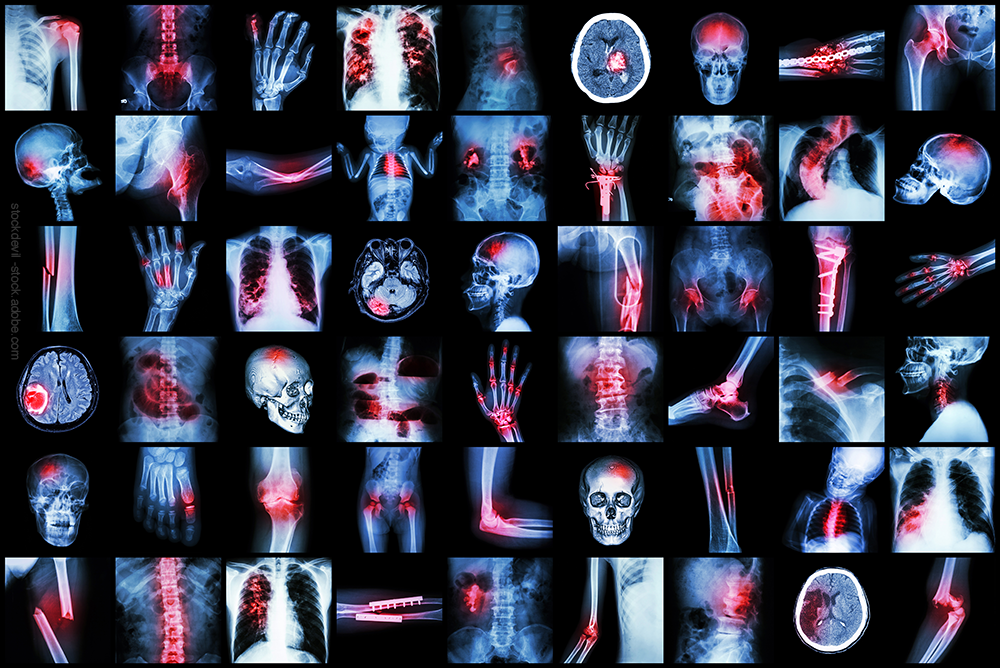 Series of Xray images