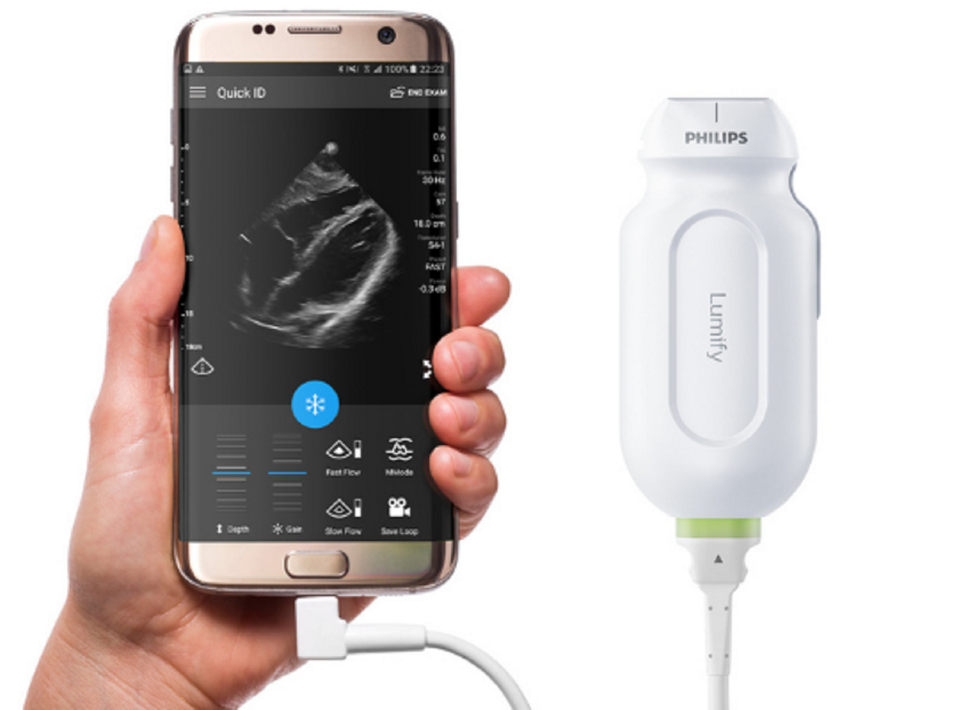Philips Expands Imaging Capabilities on Handheld Ultrasound Device