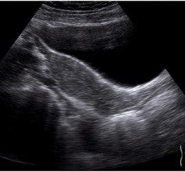 The Year of Ultrasound Brings Implementation and Innovation