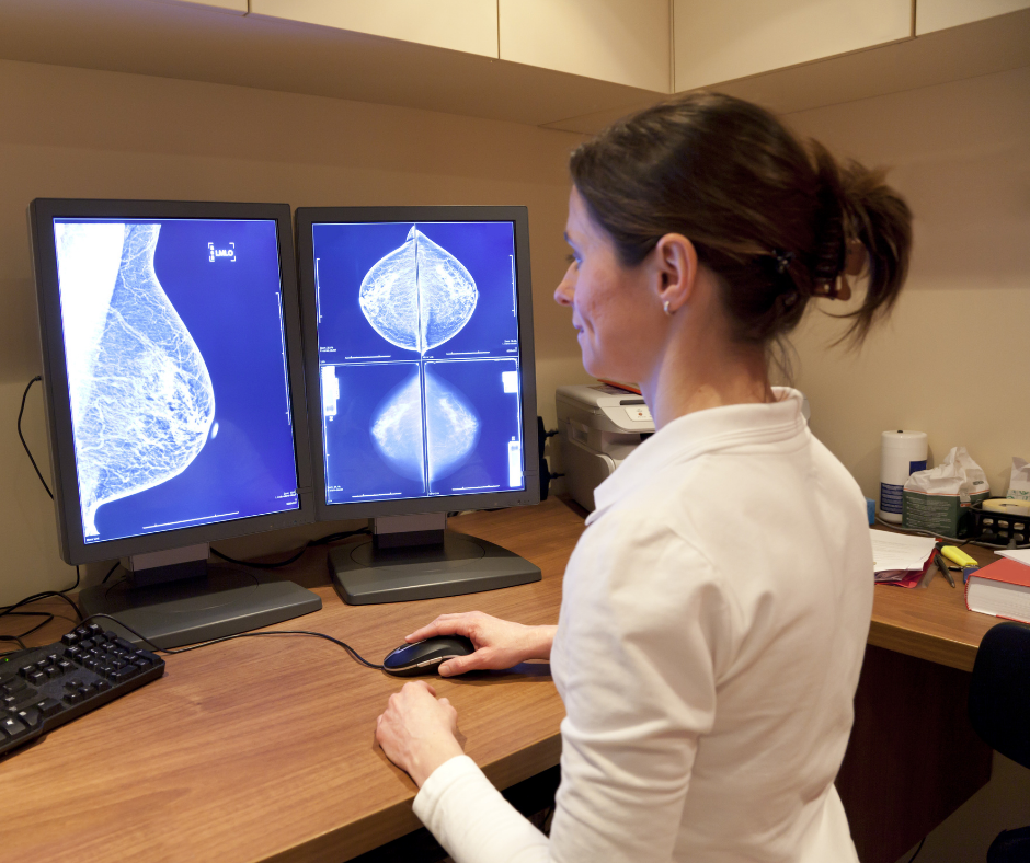 Study Looks at Recall Rates for Digital Breast Tomosynthesis and Digital Mammography