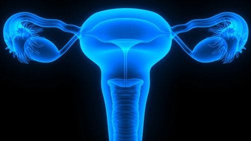 Annual Ultrasound Screening for Ovarian Cancer Fails to Reduce Deaths