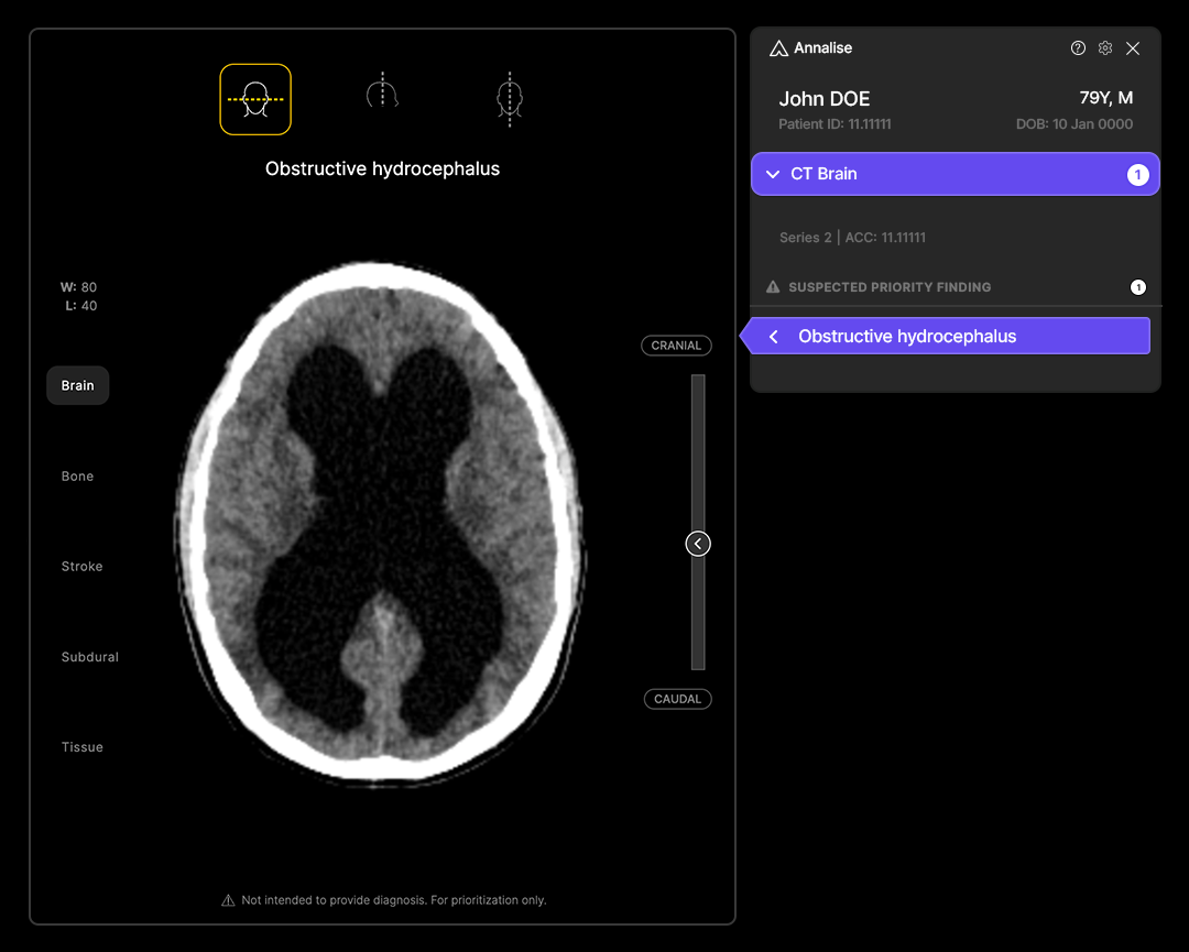 Annalise ai Introduces Radiology Triage Suite for Head CT and Chest X-Ray Exams