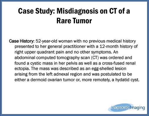 Misdiagnosis on CT of a Rare Tumor