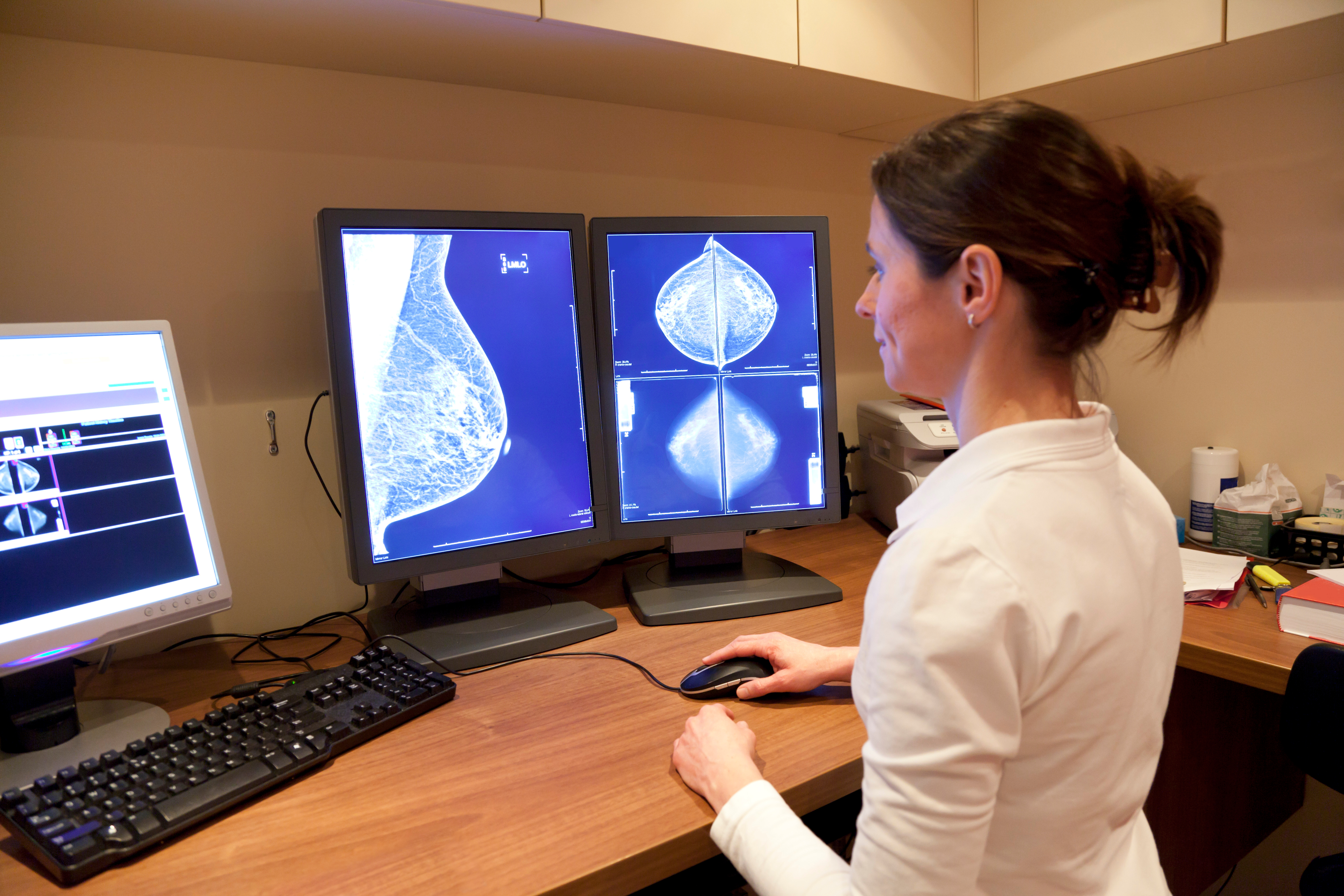 FDA Issues Final Rule on National Breast Density Notification for Mammography Reports