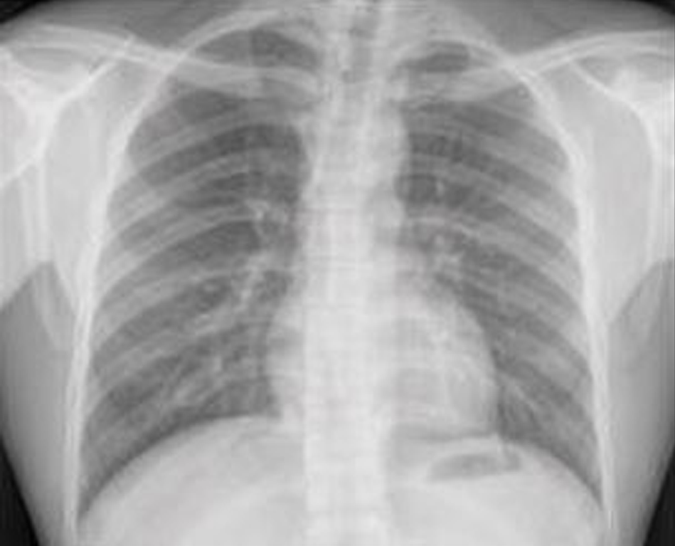 Deep Learning Model Predicts 10-Year Cardiovascular Disease Risk from Chest X-Rays