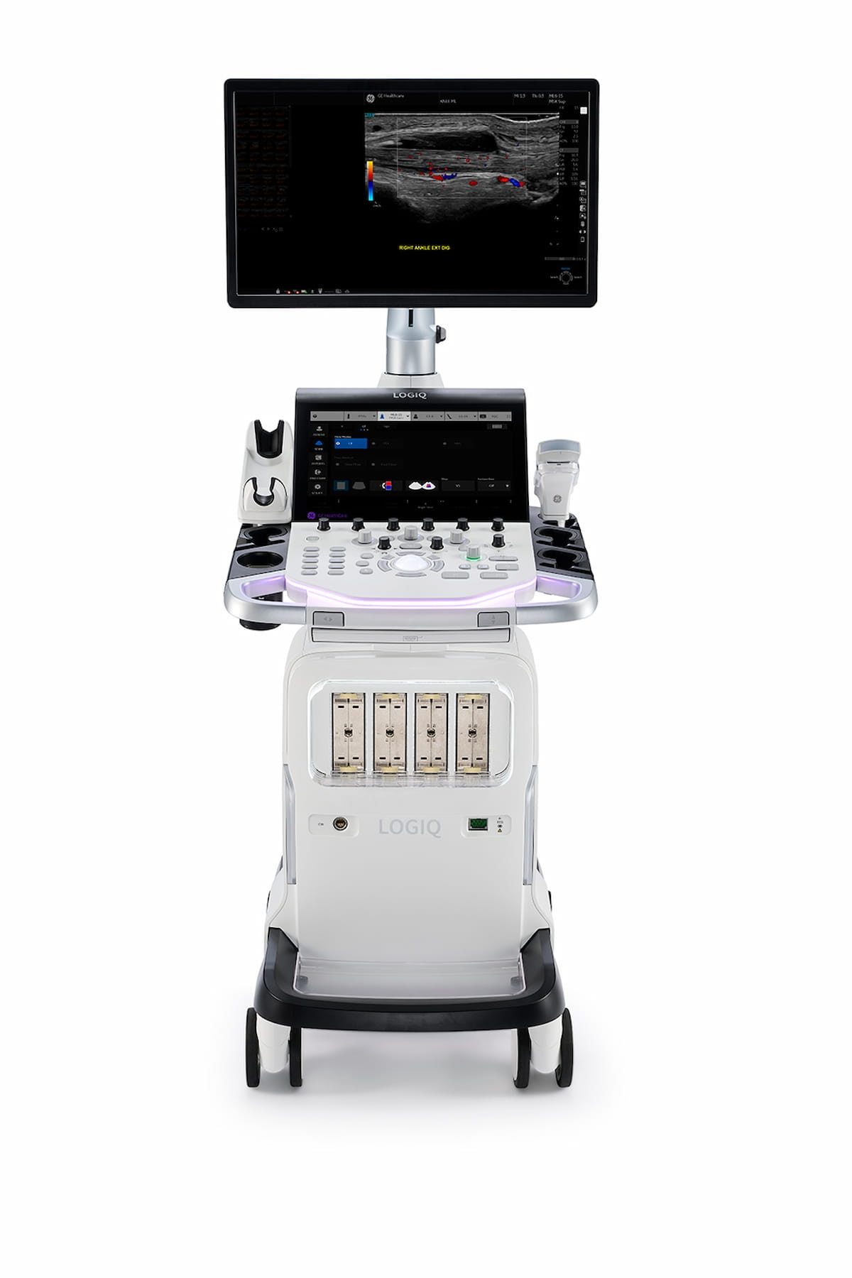 GE HealthCare Unveils Logiq Totus Ultrasound at ECR