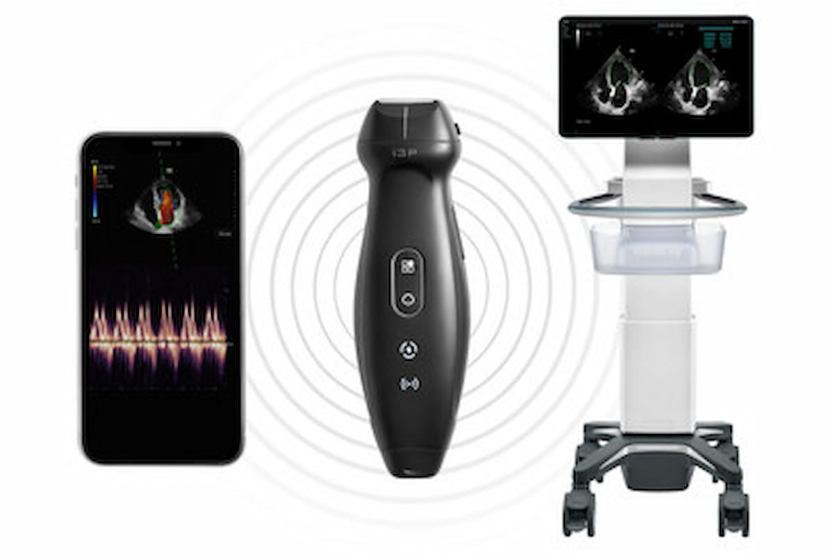 Mindray Launches New TE Air Handheld Ultrasound Device