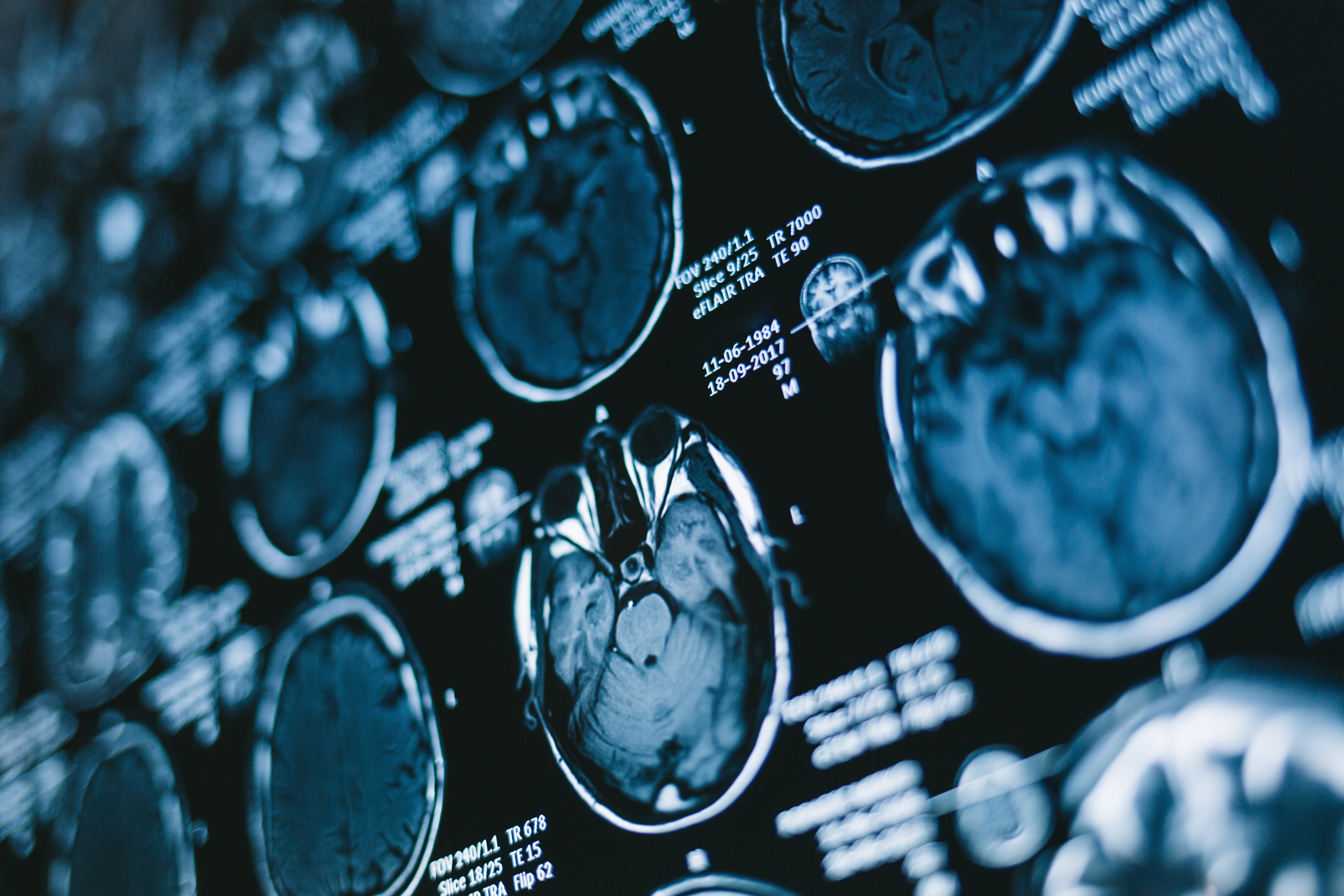 Emerging Deep Learning System May Enhance MRI Assessment of Intracranial Tumors
