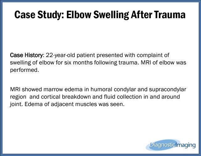 Elbow Swelling After Trauma