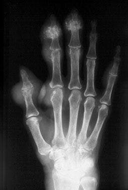 Image IQ Quiz: Patient Presents with Swollen Joints