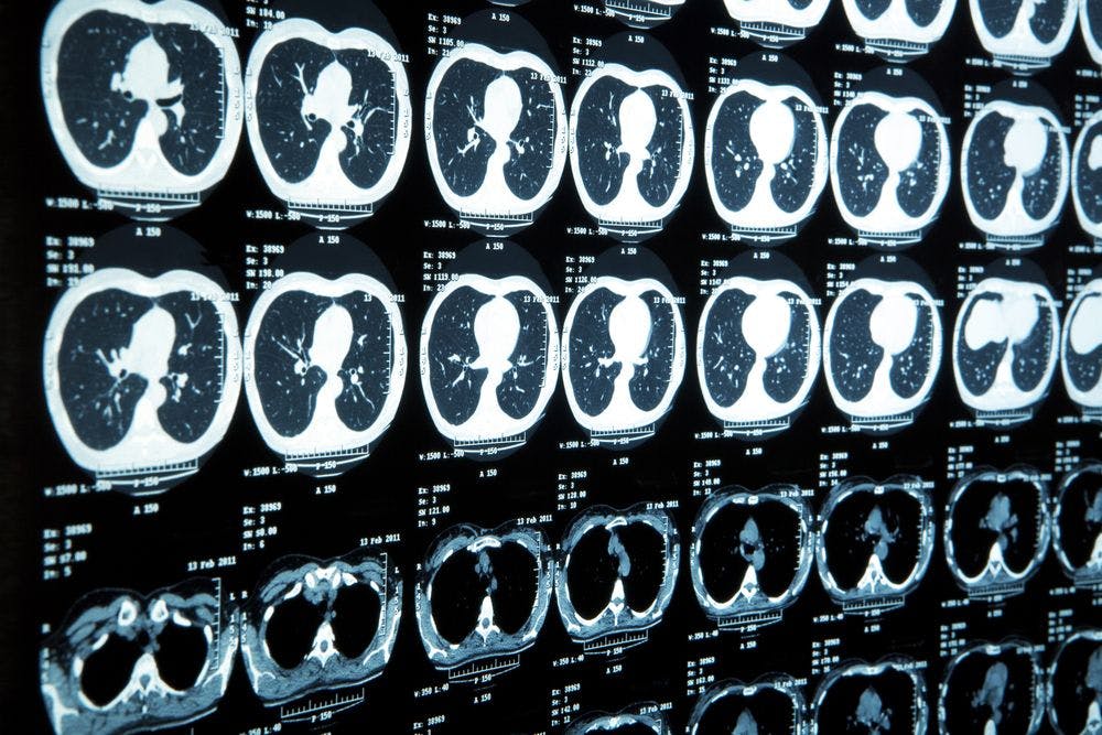 Radiology Residents Interpreting More Images