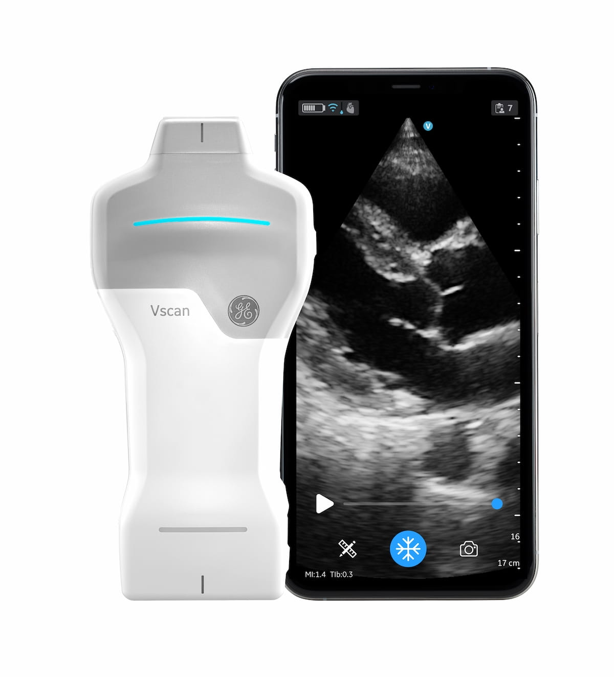 GE HealthCare Launches New Handheld Ultrasound Device at ESC Congress