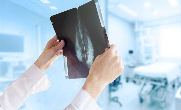 Fewer Recalls with Synthesized Mammography Plus Digital Breast Tomosynthesis 