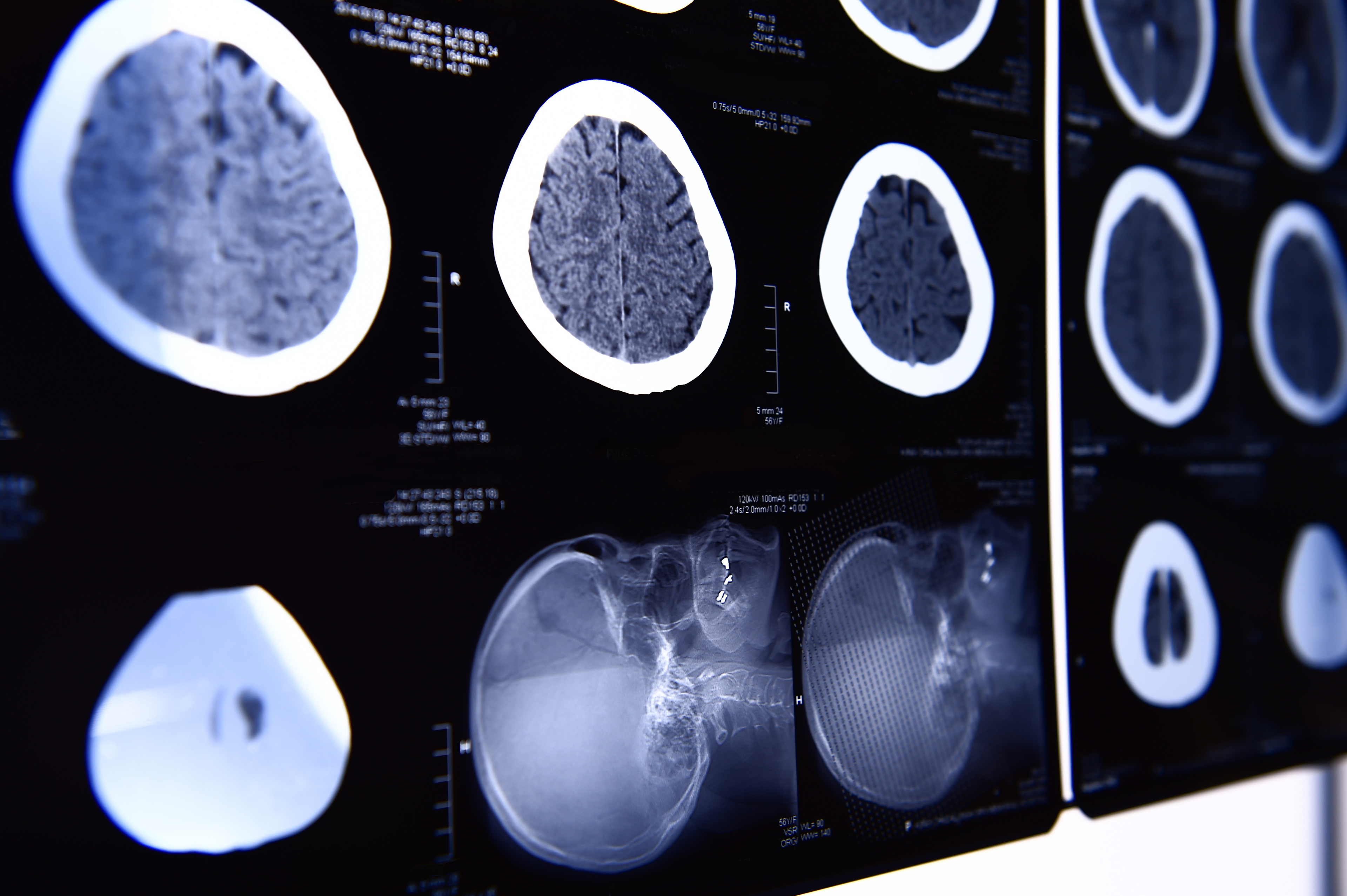 GE Healthcare Announces Moves to Bolster Supply of Iodinated Contrast Media for CT and X-Ray Imaging