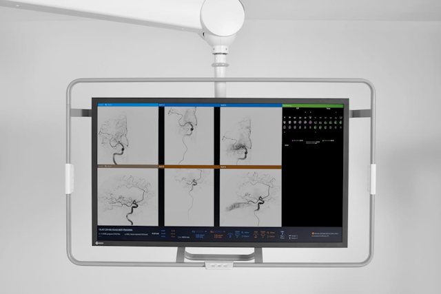 FDA Clears AI-Powered Quantitative Perfusion Mapping for Cone-Beam CT 