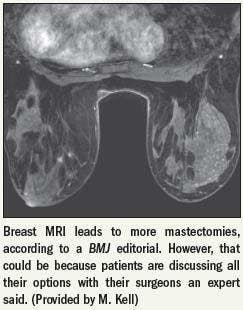 Breast MRI's role in mastectomies remains open