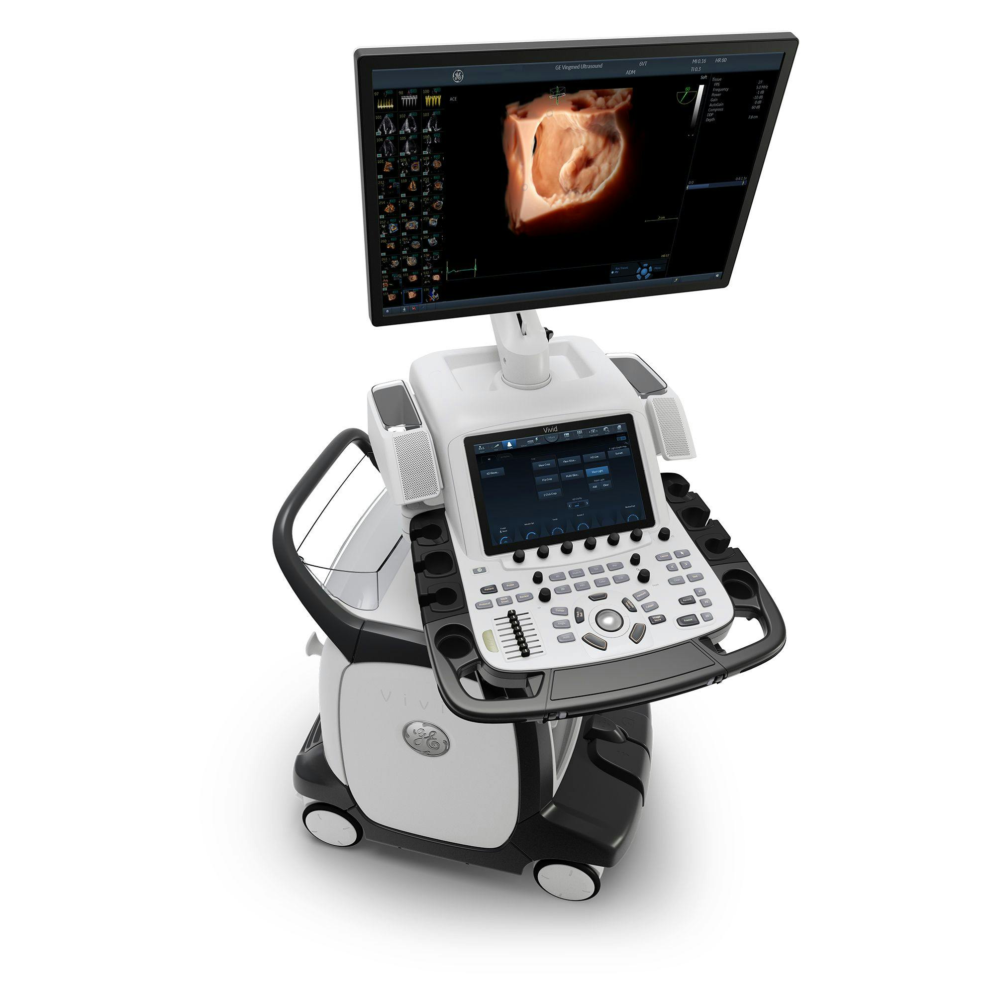GE Healthcare Secures FDA Clearance for Faster, More Consistent Cardiovascular Ultrasound
