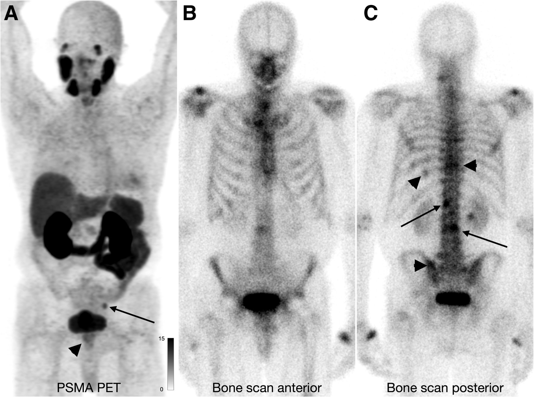 Images courtesy of the Journal of Nuclear Imaging.
