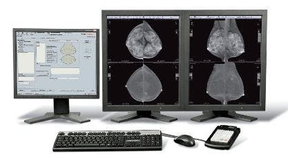 FDA Approves GE’s SenoBright Spectral Mammography Device