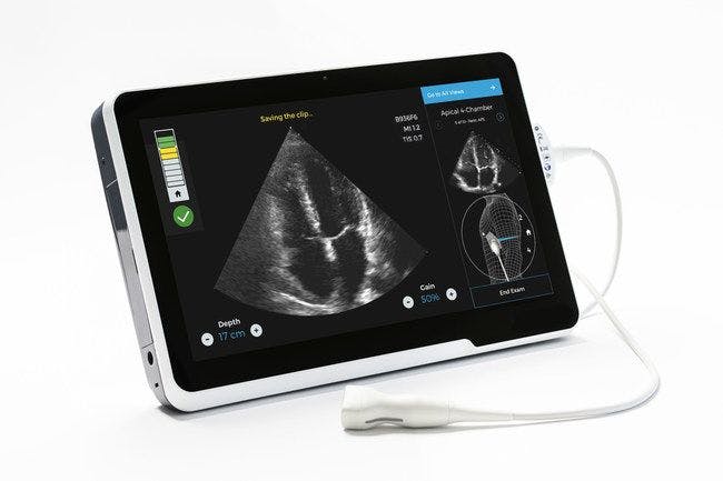 Caption Health Receives Expediated Clearance for AI-Guided Cardiac Ultrasound Tool