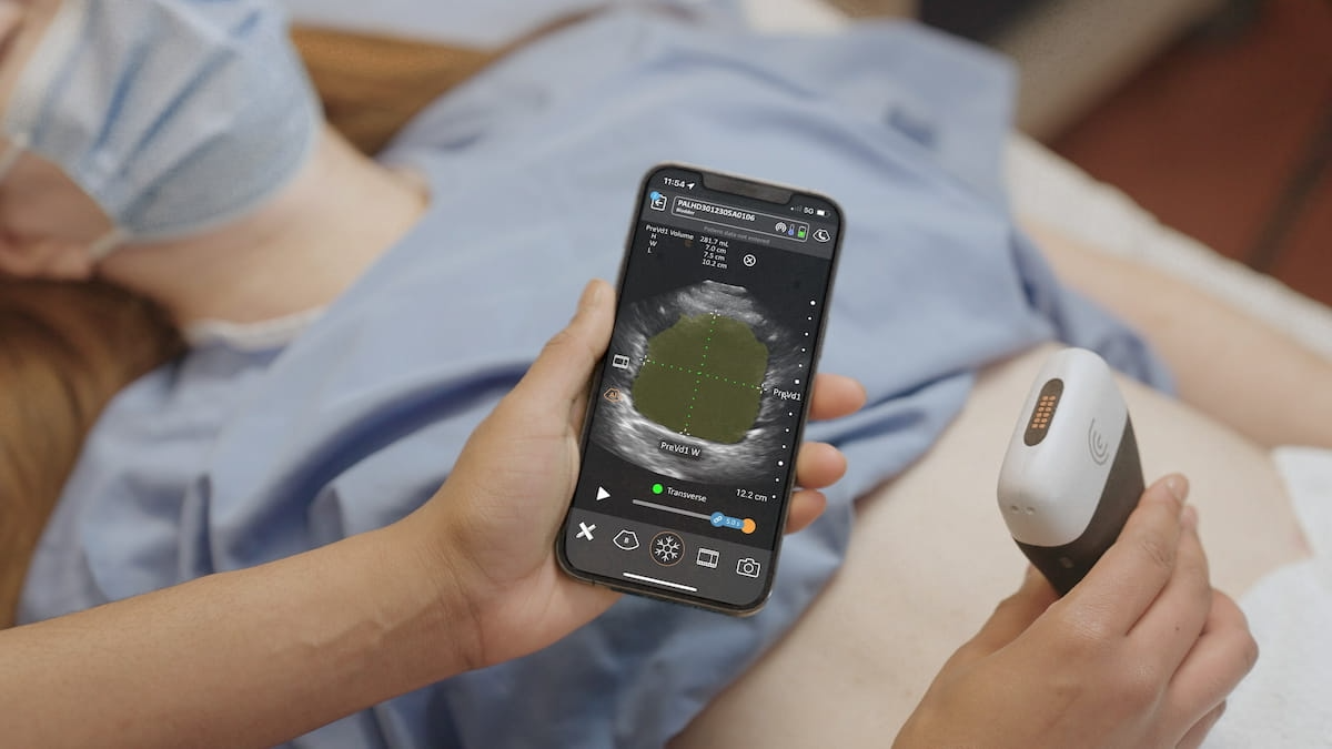 FDA Clears AI-Powered Bladder Volume Measurement for Handheld Ultrasound 