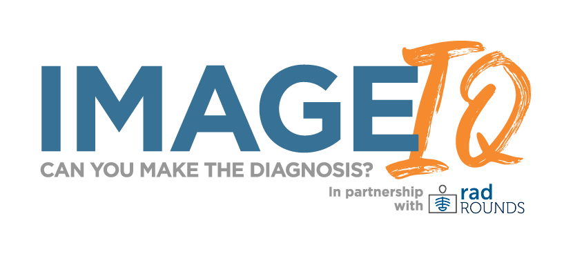 Image IQ Quiz: Patient Presents with Severe Epigastric Pain