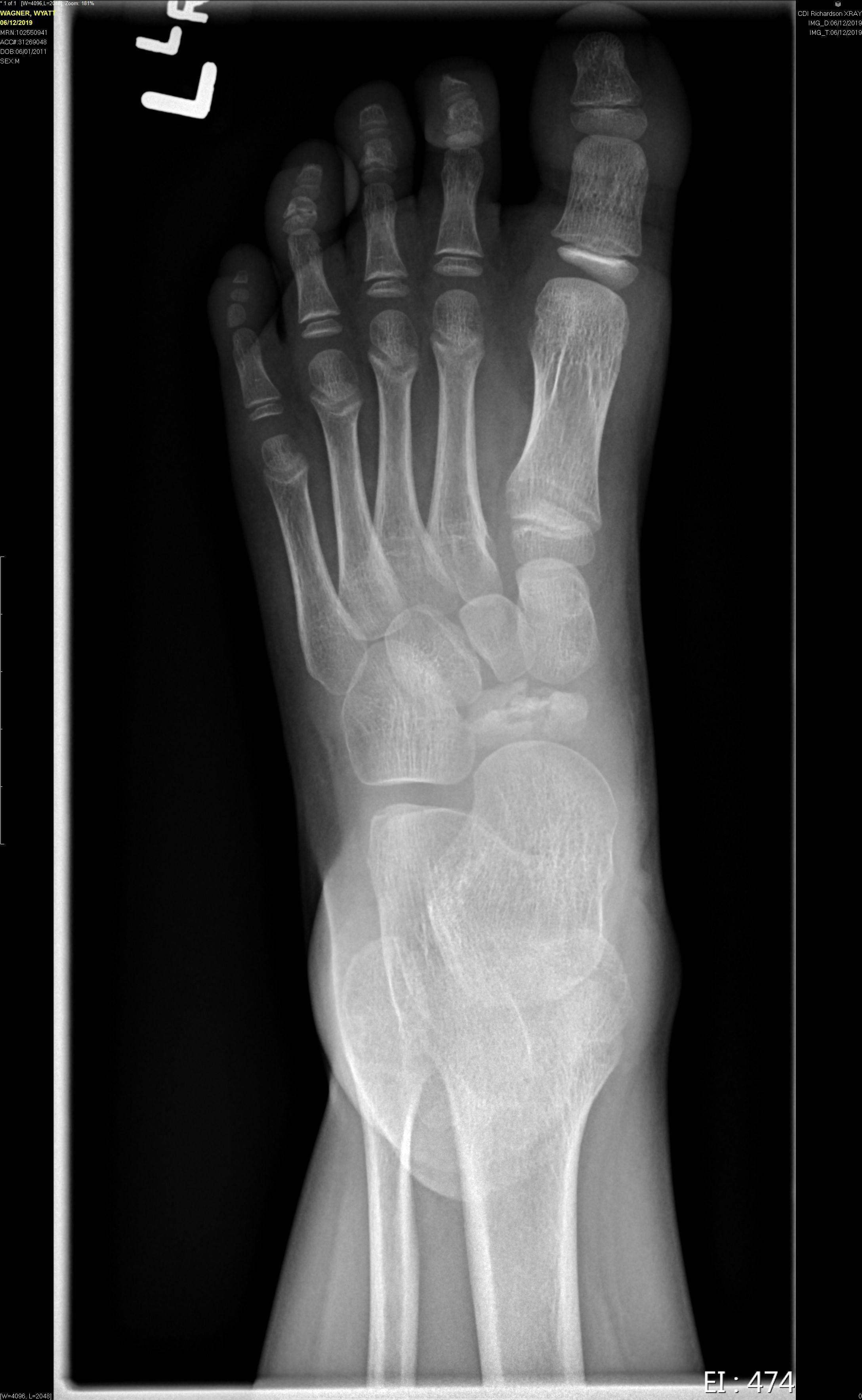 Image IQ Quiz: Pediatric Patient Presents with Foot Finding