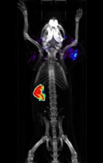 PET scans reveal cell-to-cell combat