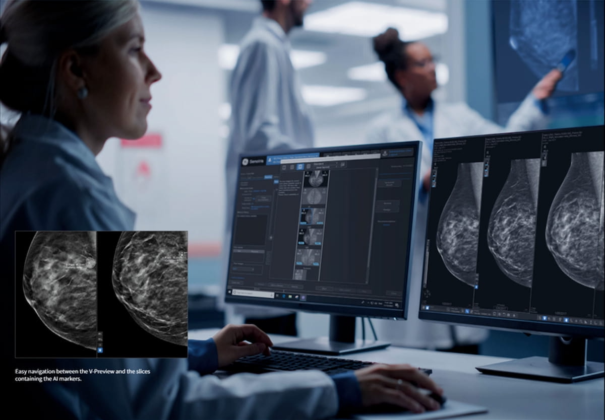 GE Healthcare Launches AI Mammography Platform with Key Applications from iCAD
