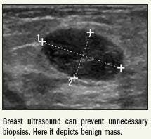 Studies show how breast ultrasound reduces unnecessary biopsies