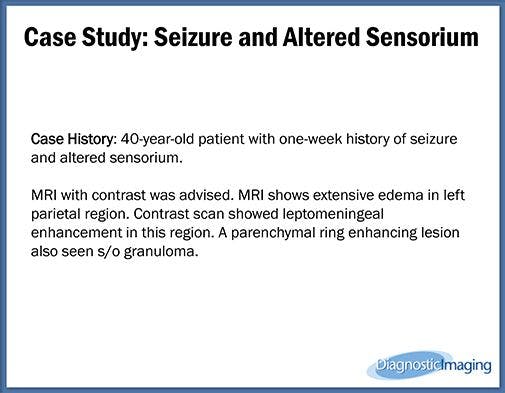 Seizure and Altered Sensorium