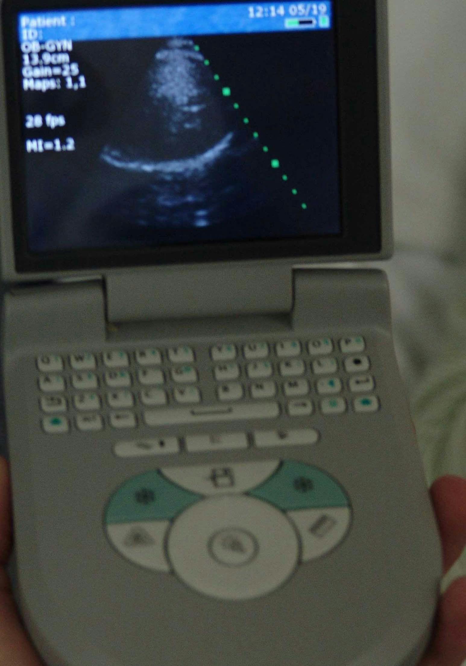 U.K. midwives take ultrasound into the community