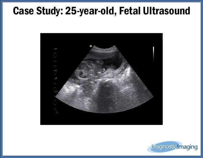 25-year-old, Fetal Ultrasound