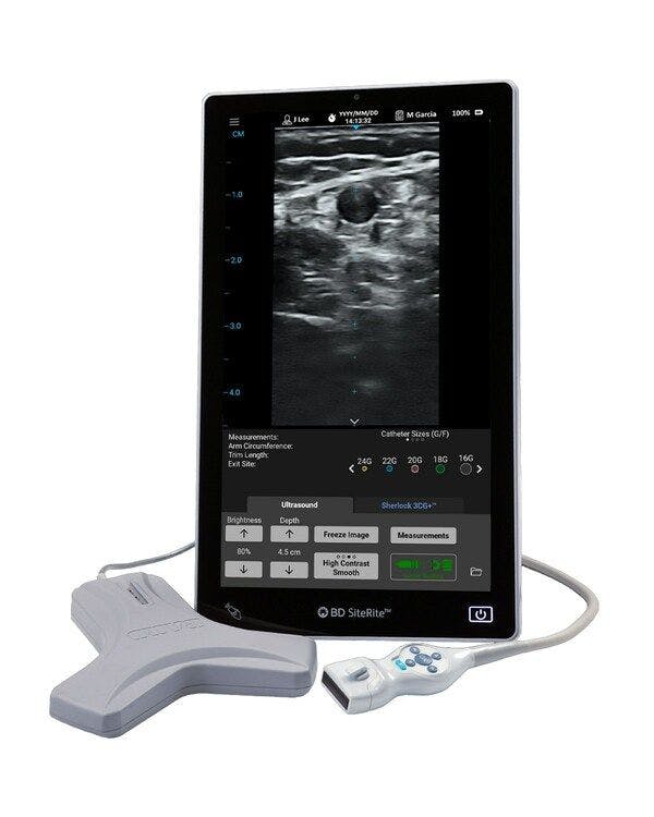 New Ultrasound System Facilitates Catheter and IV Placement