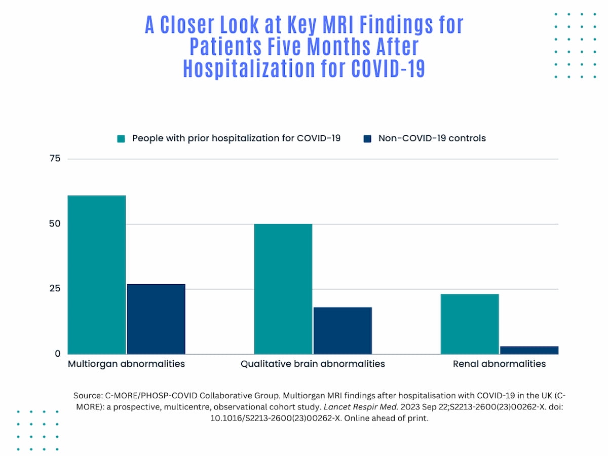 MRI Study: People with Past Hospitalization for COVID-19 Have Nearly Triple the Risk of Multiorgan Abnormalities